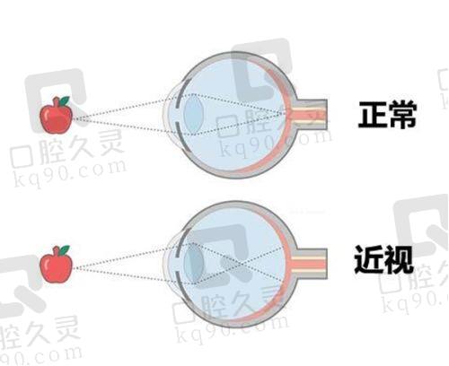 二、南宁晶亮眼科医院怎么样？