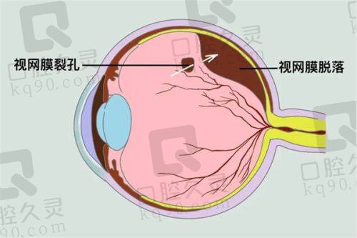 天水爱尔眼科医院是公立还是私立？私立却凭实力成当地患者信赖之选