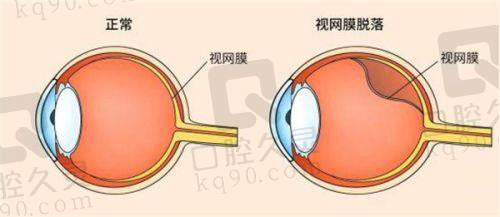 五、南宁晶亮眼科医院医生介绍