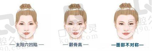 郑州管城中医院耳畸形整形费用高吗？