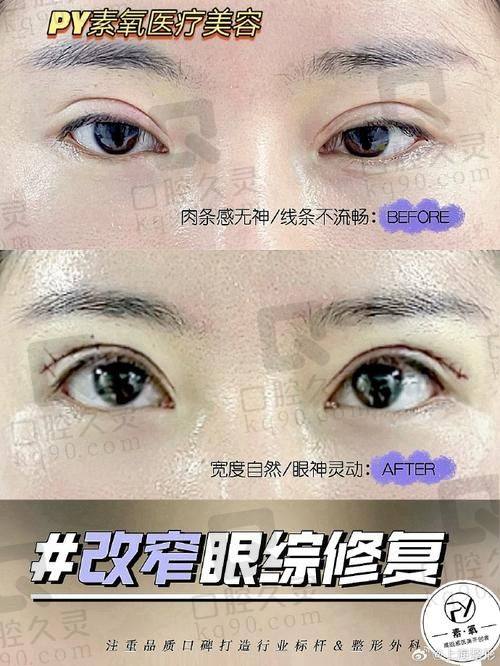 兰州时光激光整形美容医院贾治兰医生的真实的患者评价如下：
