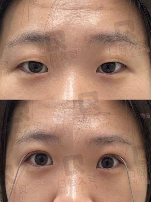 五、患者评价与实例分享