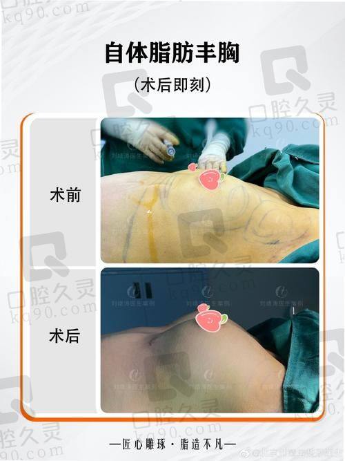 兰州时光激光整形美容医院逯岩医生做擅长项目怎么样