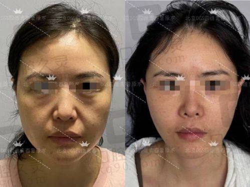 六、泸州龙马潭韩美医疗美容门诊部价格表：（仅供参考）