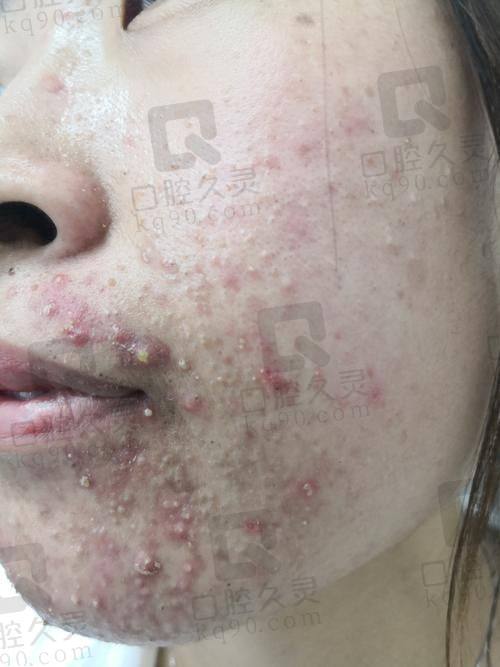 四、苏州悟空祛痘皮肤美容诊所怎么预约: