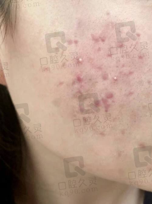 二、苏州悟空祛痘皮肤美容诊所正规吗?来看看医院资质: