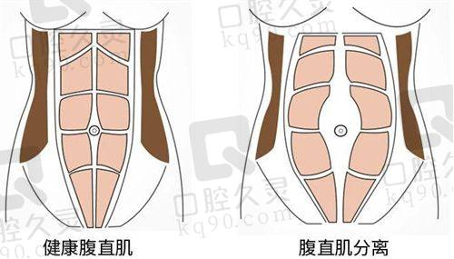 陇南禾美医疗美容诊所做三眼皮修复情况