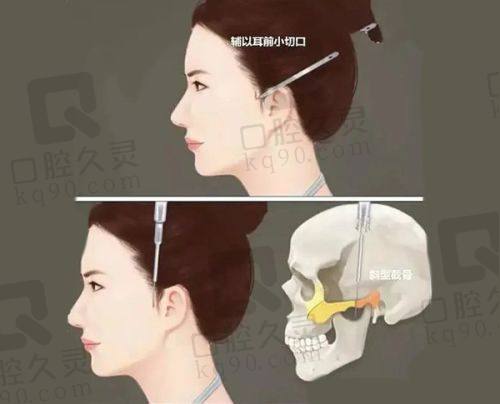 陇南禾美医疗美容诊所做肉条眼修复情况