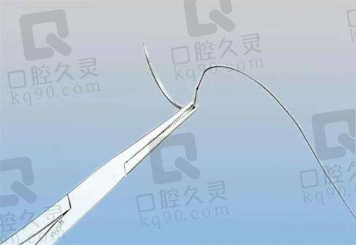 华美聂婕医生幼态脸打造怎么样？