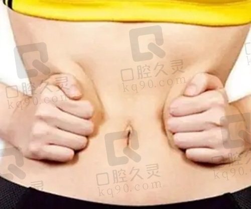 哈尔滨羽禅医美杨宇梓腰腹环吸体验，轻松瘦腰腹，术后恢复快效果超自然 
