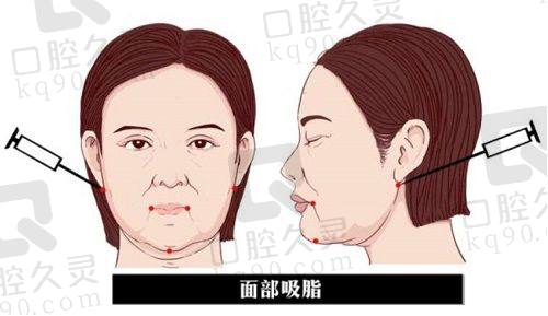无锡坤如玛丽整形医院交通路线
