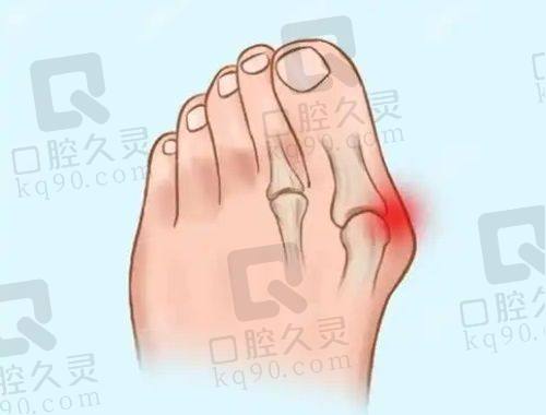 惠州整形医院鼻部整形价格如何？