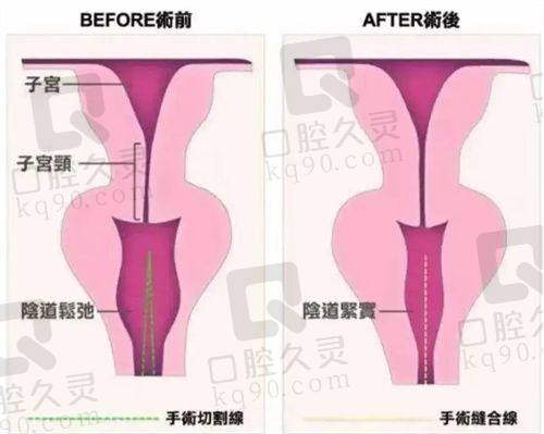 手术成效：惊艳蜕变展自信