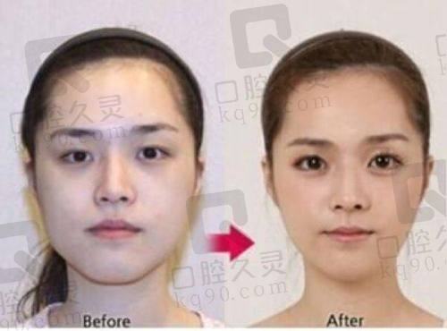 杭州美莱医疗美容医院值得选吗？