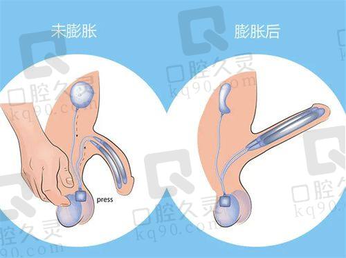 多方面优势彰显清奥实力