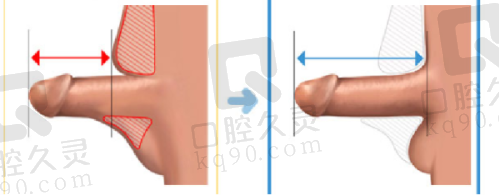 价格与性价比：高端技术的价值体现