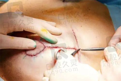郑州东方整形医院口碑怎么样？专精医生团队是关键