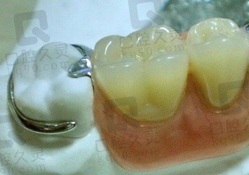 二、深圳正恩口腔种植牙经济型套餐