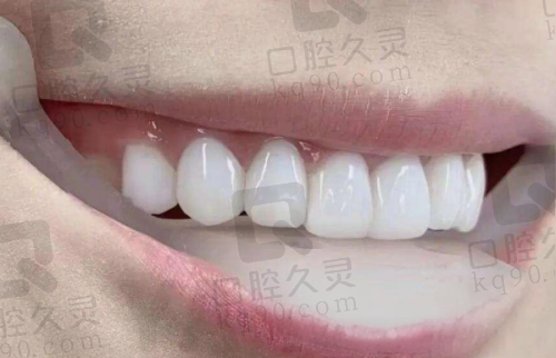 中牙口腔的矫正报价怎么样？学生党也能hold住