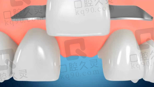 金华金东靓齿口腔诊所医院收费价格表