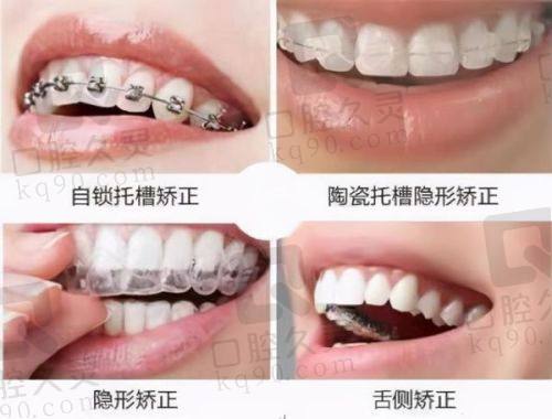 深圳穗华口腔的口碑评价与服务特色