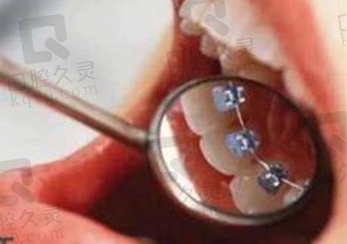 五、长春叁肆伍口腔医院是正规医院吗之价格透明