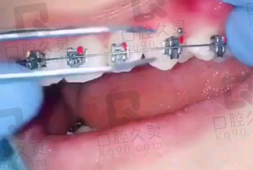 张家口麦格口腔医院在哪个位置？位于桥西清水河中路3号食品世界3层3 - 1！ 