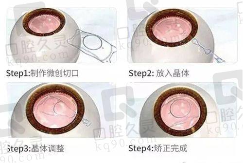 五、泉州惠明欧普眼科诊所医生介绍