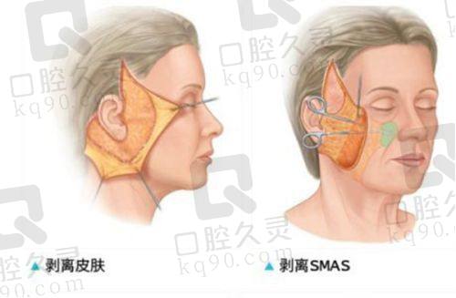 广州美恩整形植发科口碑如何？