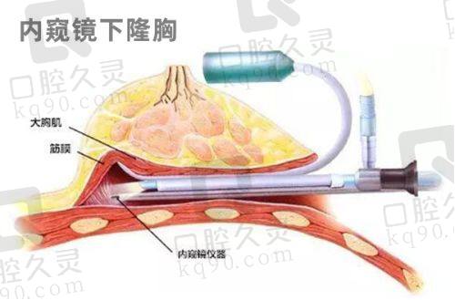 广州美恩整形植发科预约挂号方式：