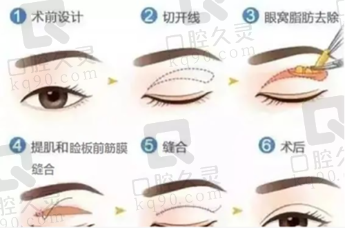 价格对比