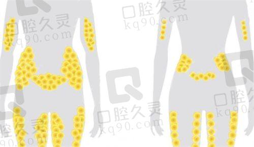 想在西安做隆胸隆鼻双眼皮?西安艺星医美正规靠谱,值得面诊!