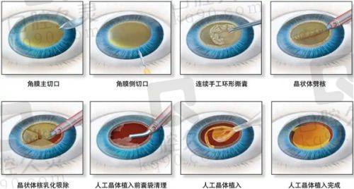 广州美恩整形植发科收费价格表：