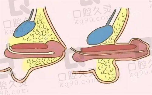 四、广州地区整形项目价格参考表（以下价格仅供参考）