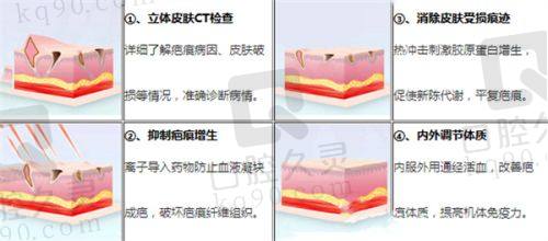 哈尔滨艺星医疗美容医院疤痕修复适用类型及成效如何？