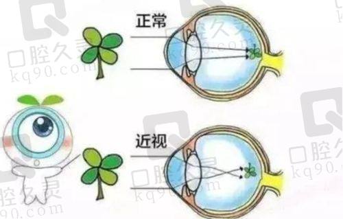 深圳福田爱尔眼科医院的预约攻略