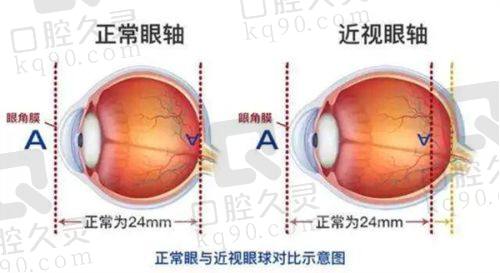 徐州复兴眼科医院的医生有哪些骨干医生——近视矫正骨干医生