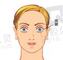 总结：该如何选择西安医大眼科医院和四院？