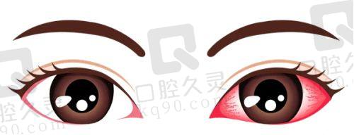深圳福田爱尔眼科医院的优势总结