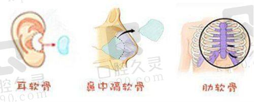 总结