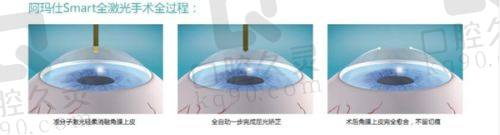 九、泉州惠明欧普眼科诊所真实的患者评价