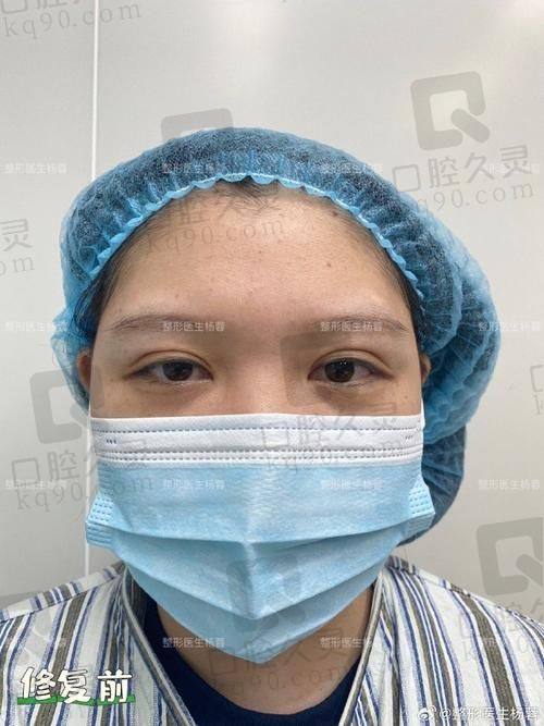 医院综合实力为双眼皮手术保驾护航