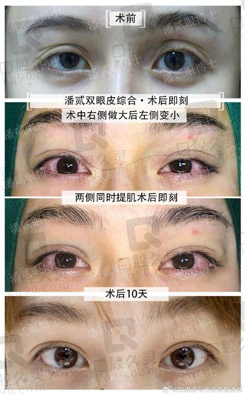 多样手术技术与独特审美理念