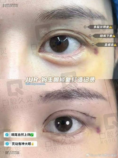 二、王克华医生擅长技术