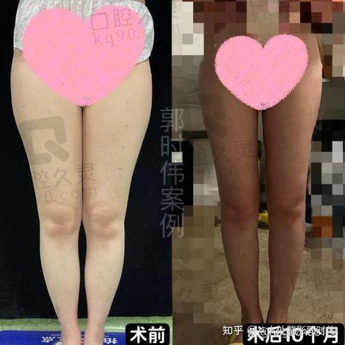 三、医院实力：北京知音医美20年口碑积淀