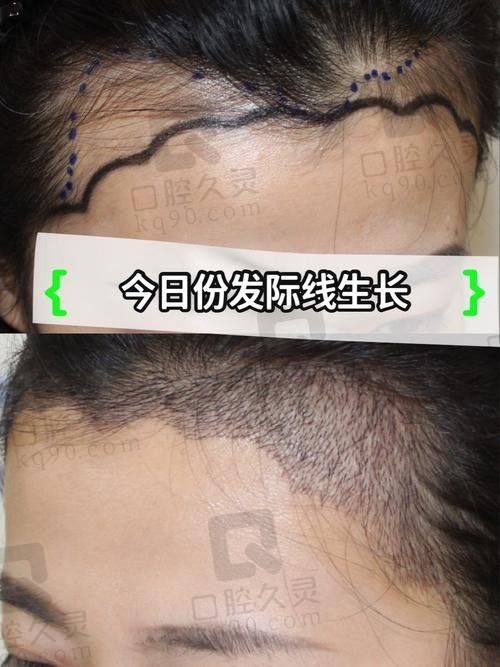 总结
