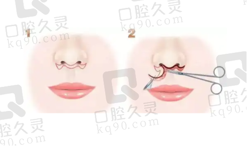 三、重庆当代整形外科医院口碑如何不妨来看集美们的实例评价。
