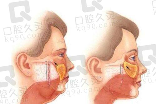 六、广州壹加壹医疗美容医院医生收费价目表