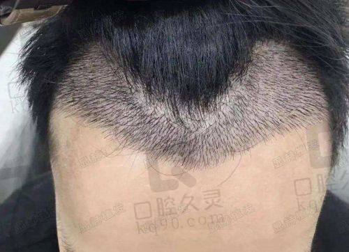 西安高一生医疗美容医院收费价格表查询，还有真实案例分析，值得信赖的选择！