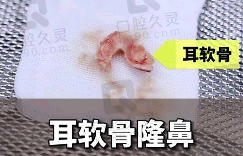 三、深圳八大处医疗美容医院口碑如何不妨来看集美们的实例评价